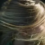 Consigli di estetica oncologica